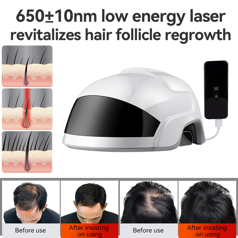 Red Light Laser Therapy Hair Growth Helmet