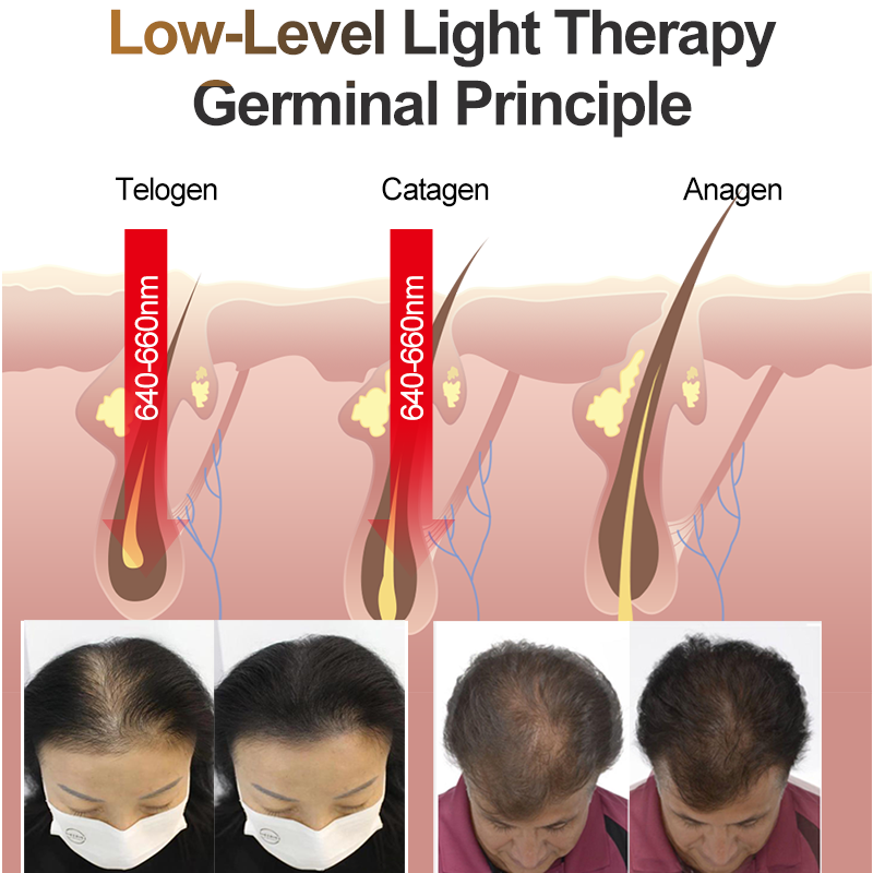 Red Light Laser Therapy Hair Growth Helmet