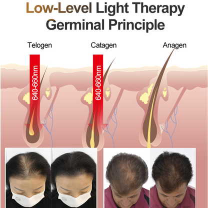 Red Light Laser Therapy Hair Growth Helmet